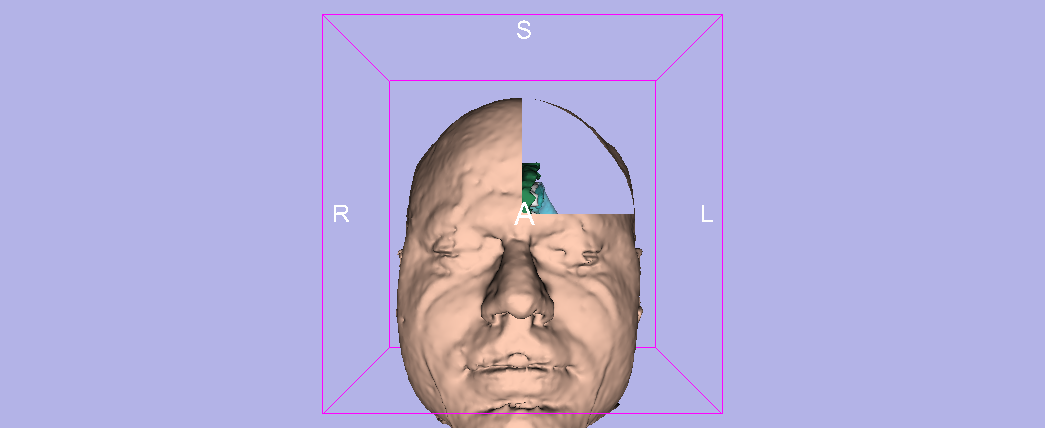3D