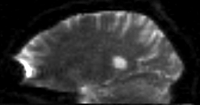 this is the fixed reference image. All images are aligned into this space