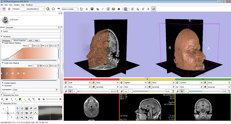 File:QSlicerVolumeRenderingModule-DualView.png