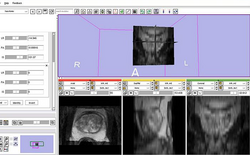 ProstatePlanningOverview.png