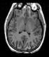 Target Brain