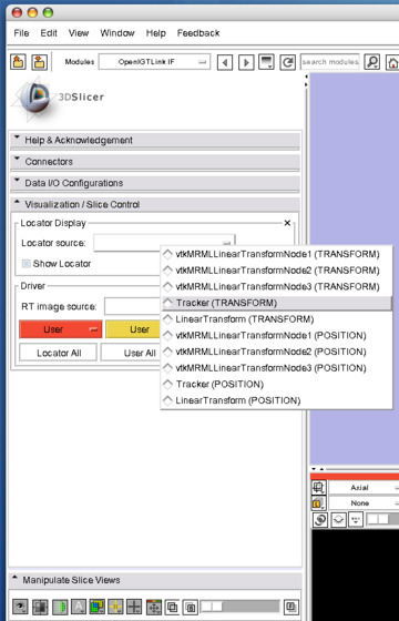 Slicer3 OpenIGTLinkIF Visualization locator source.png