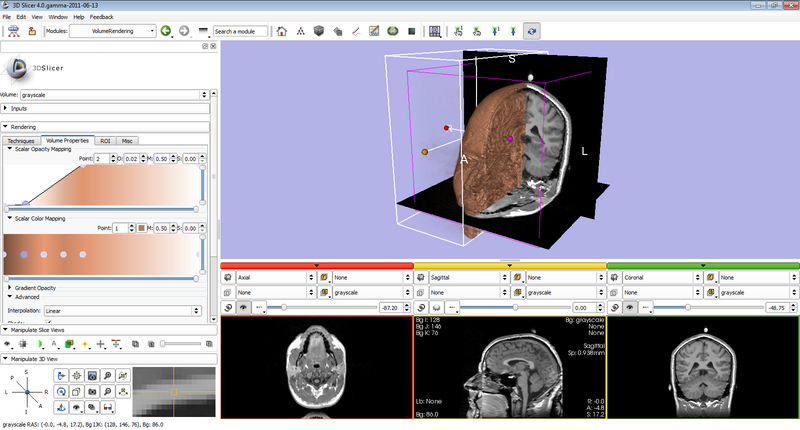 File:SlicerWithVolumeRendering.png